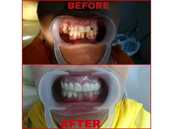 Dr. Pooja Dental