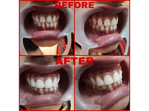 Dr. Pooja Dental