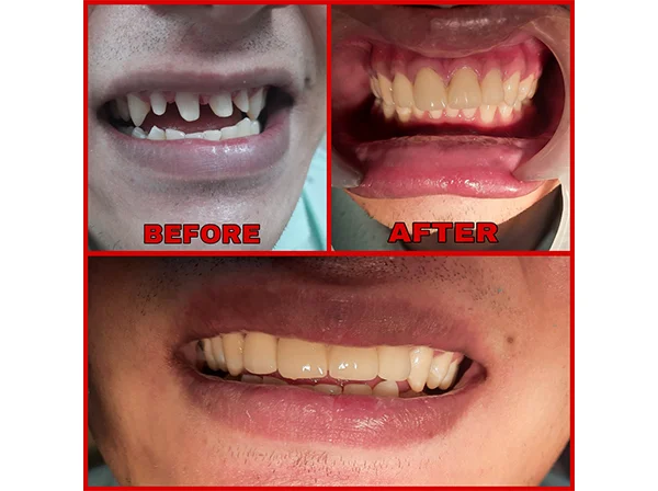 Dr. Pooja Dental