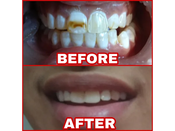 Dr. Pooja Dental
