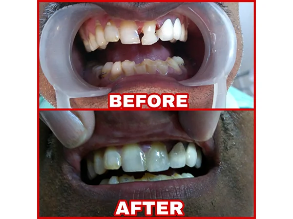 Dr. Pooja Dental