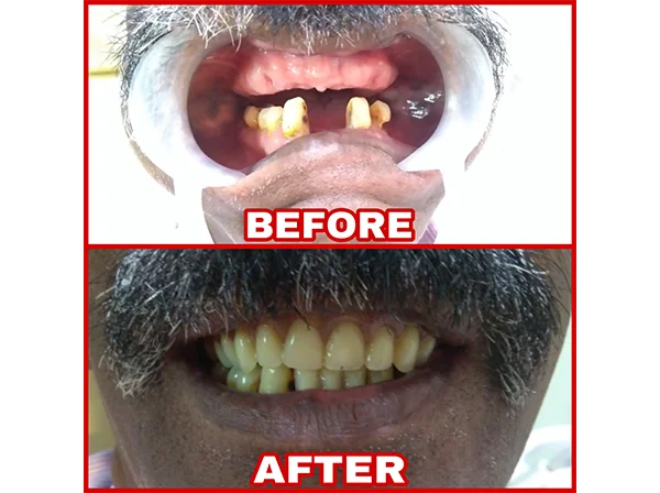 Dr. Pooja Dental