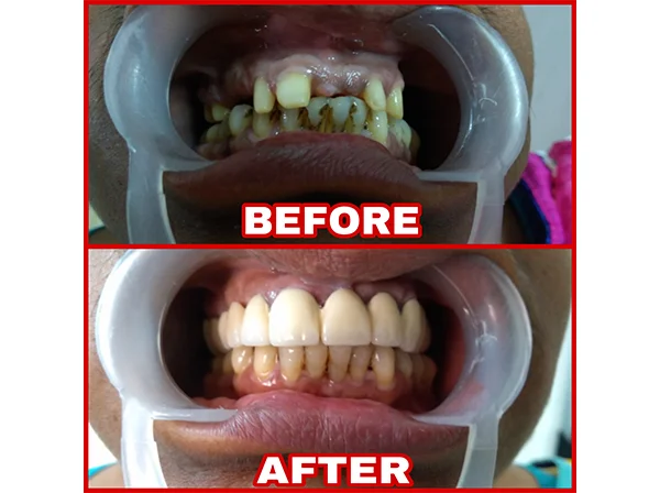 Dr. Pooja Dental