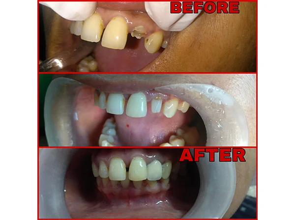 Dr. Pooja Dental