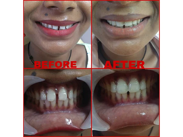 Dr. Pooja Dental
