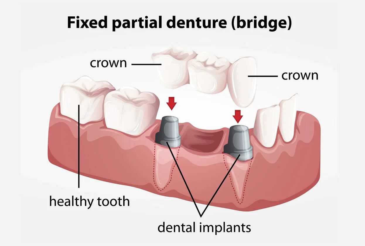 Removable & Fixed Dental